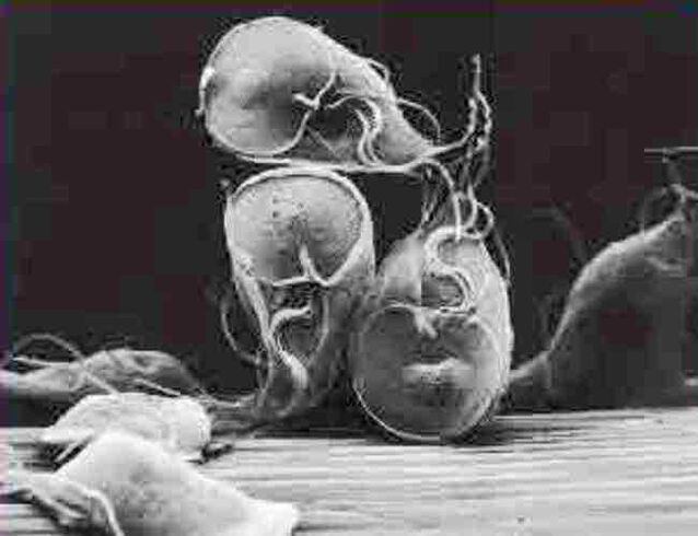 protozojski parazit giardia